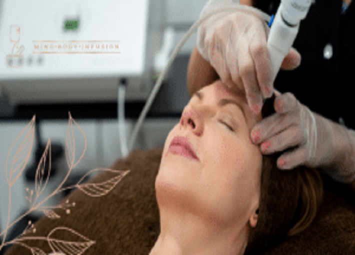 Microdermabrasion Treatment in Clarita, CA, at Mind Body Infusion.