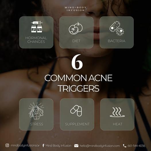 Acne-Prone Skin: 6 Common Triggers You Need to Know About